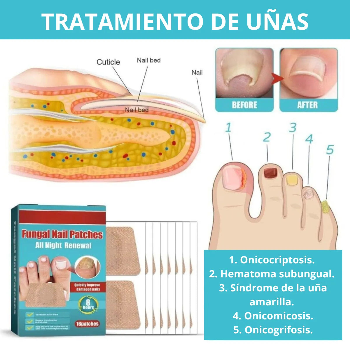 PARCHE UÑAS ANTIHONGOS x16
